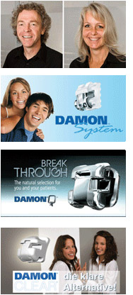 Damon-System-Bracket-System